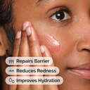 ord-soothing-barrier-support-serum-model-application-with-benefits.jpg.webp